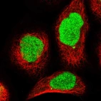 Immunofluorescent staining of human cell line A-431 shows localization to nucleus.