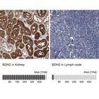 Anti-BDH2 Antibody
