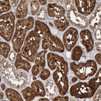 Immunohistochemical staining of human kidney shows strong cytoplasmic positivity in cells in tubules.