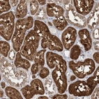 Immunohistochemical staining of human kidney shows strong cytoplasmic positivity in cells in tubules.