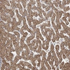 Immunohistochemical staining of human liver shows strong granular cytoplasmic positivity in hepatocytes.