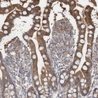 Immunohistochemical staining of human small intestine shows moderate cytoplasmic positivity in glandular cells.