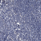 Immunohistochemical staining of human lymph node shows no positivity in non-germinal center cells as expected.
