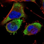 Immunofluorescent staining of human cell line U-251 MG shows localization to cytosol.