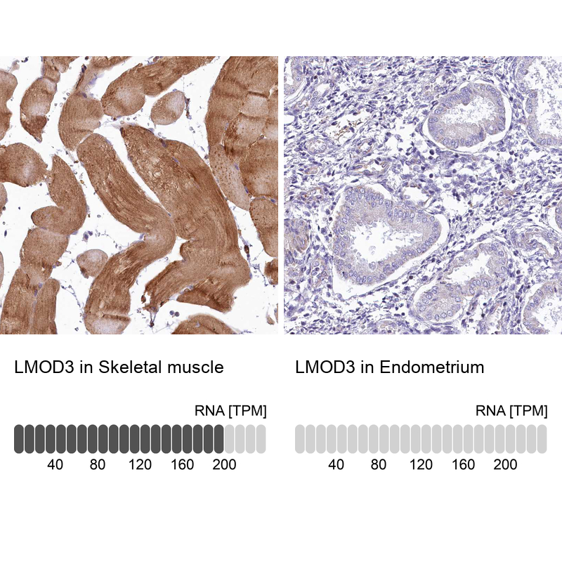 Anti-LMOD3 Antibody