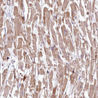 Immunohistochemical staining of human heart muscle shows strong cytoplasmic positivity in cardiomyocytes.