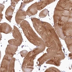 Immunohistochemical staining of human skeletal muscle shows strong cytoplasmic positivity in myocytes.