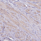 Immunohistochemical staining of human prostate shows weak cytoplasmic positivity in smooth muscle cells.