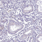 Immunohistochemical staining of human endometrium shows no cytoplasmic positivity in glandular cells as expected.