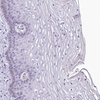 Immunohistochemical staining of human cervix, uterine shows no cytoplasmic positivity in squamous epithelial cells as expected.