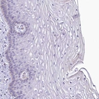 Immunohistochemical staining of human cervix, uterine shows no cytoplasmic positivity in squamous epithelial cells as expected.