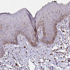 Anti-FCER1A Antibody