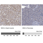 Anti-BSG Antibody