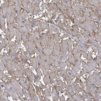 Anti-BSG Antibody