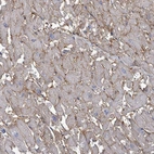 Immunohistochemical staining of human heart muscle shows high expression.