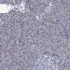 Anti-BSG Antibody