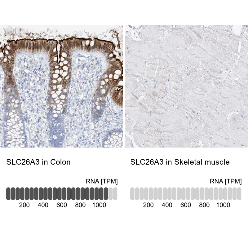 Anti-SLC26A3 Antibody