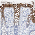 Immunohistochemical staining of human colon shows moderate positivity in glandular cells of apical membrane.