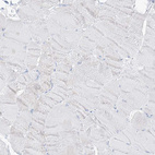 Immunohistochemical staining of human skeletal muscle shows no positivity in myocytes as expected.