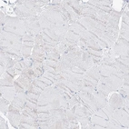 Immunohistochemical staining of human skeletal muscle shows no positivity in myocytes as expected.