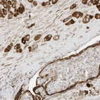 Anti-PTK6 Antibody