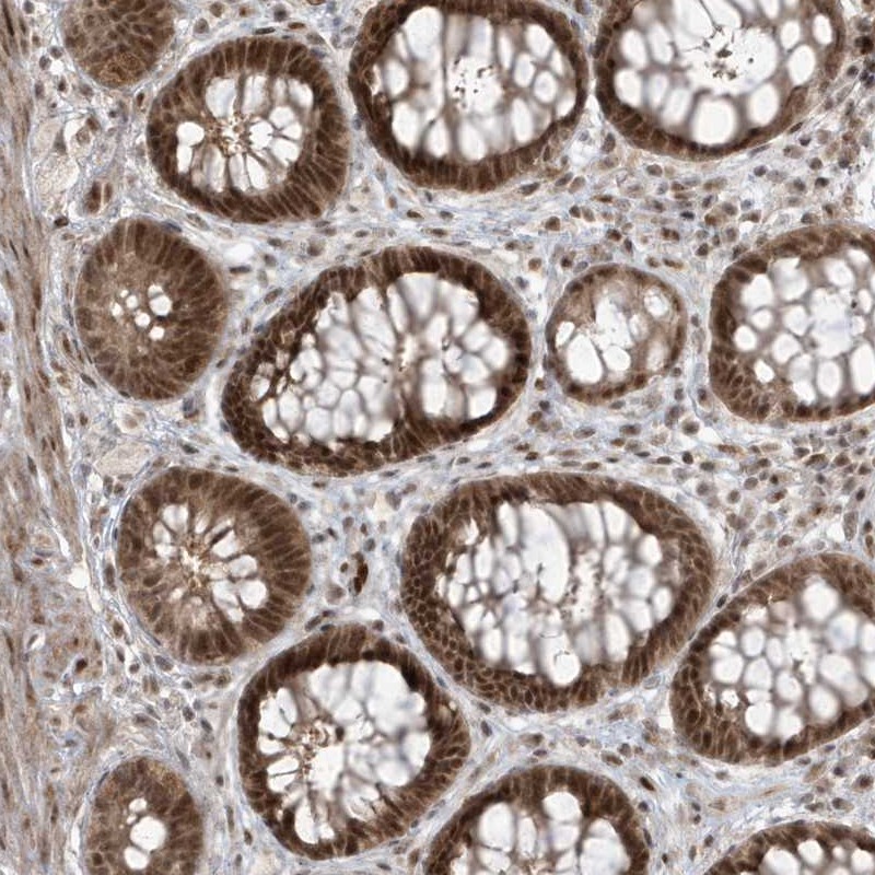 Anti-C1orf52 Antibody