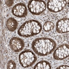 Anti-C1orf52 Antibody