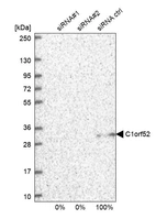 Western blot analysis in U2OS cells transfected with control siRNA, target specific siRNA probe #1 and #2, using Anti-C1orf52 antibody. Remaining relative intensity is presented.
