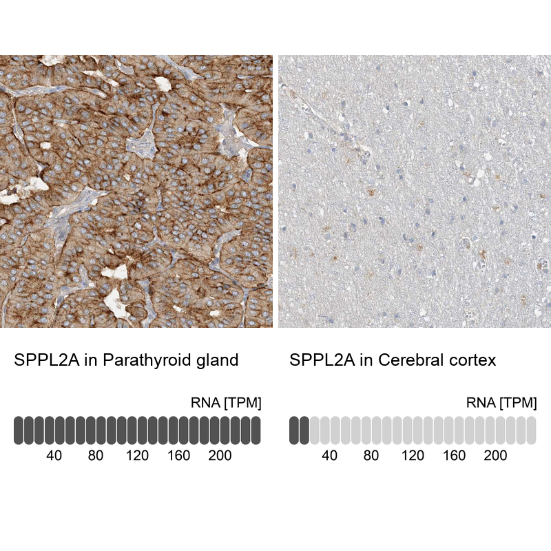 Anti-SPPL2A Antibody