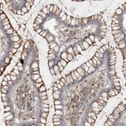 Immunohistochemical staining of human colon shows moderate membranous positivity in glandular cells.