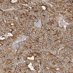 Immunohistochemical staining of human parathyroid gland shows moderate positivity in glandular cells.