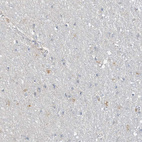 Immunohistochemical staining of human cerebral cortex shows weak positivity.