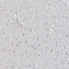 Immunohistochemical staining of human cerebral cortex shows weak positivity.