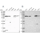Western blot analysis using Anti-RNPEP antibody HPA036075 (A) shows similar pattern to independent antibody HPA036074 (B).