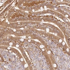 Anti-RNPEP Antibody