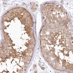 Immunohistochemical staining of human testis shows moderate cytoplasmic positivity in cells in seminiferous ducts.