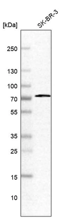 Western blot analysis in human cell line SK-BR-3.