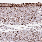 Anti-ELK1 Antibody