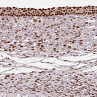 Immunohistochemical staining of human ovary shows high expression.
