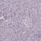 Immunohistochemical staining of human pancreas shows low expression as expected.