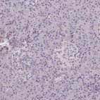 Immunohistochemical staining of human pancreas shows low expression as expected.