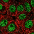 Immunofluorescent staining of human cell line MCF7 shows localization to nucleoplasm.