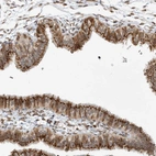 Anti-SLC35A2 Antibody