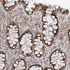 Immunohistochemical staining of human Rectum shows strong granular cytoplasmic positivity in glandular cells.