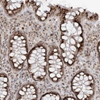 Immunohistochemical staining of human Rectum shows strong granular cytoplasmic positivity in glandular cells.