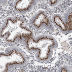 Immunohistochemical staining of human Endometrium shows strong granular cytoplasmic positivity in glandular cells.