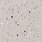 Immunohistochemical staining of human Cerebral cortex shows moderate granular cytoplasmic positivity in neuronal and glial cells.