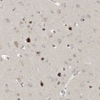 Immunohistochemical staining of human Cerebral cortex shows moderate granular cytoplasmic positivity in neuronal and glial cells.