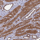 Anti-TNS1 Antibody