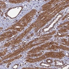 Anti-TNS1 Antibody